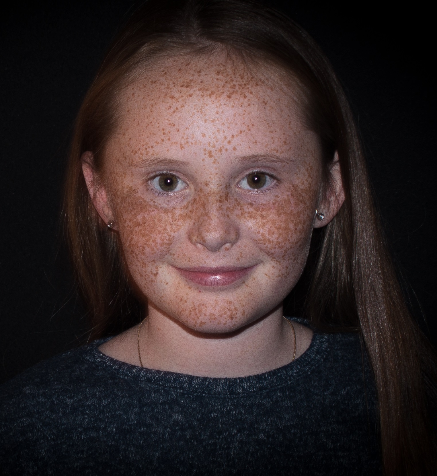 freckles-girls (8).jpg
