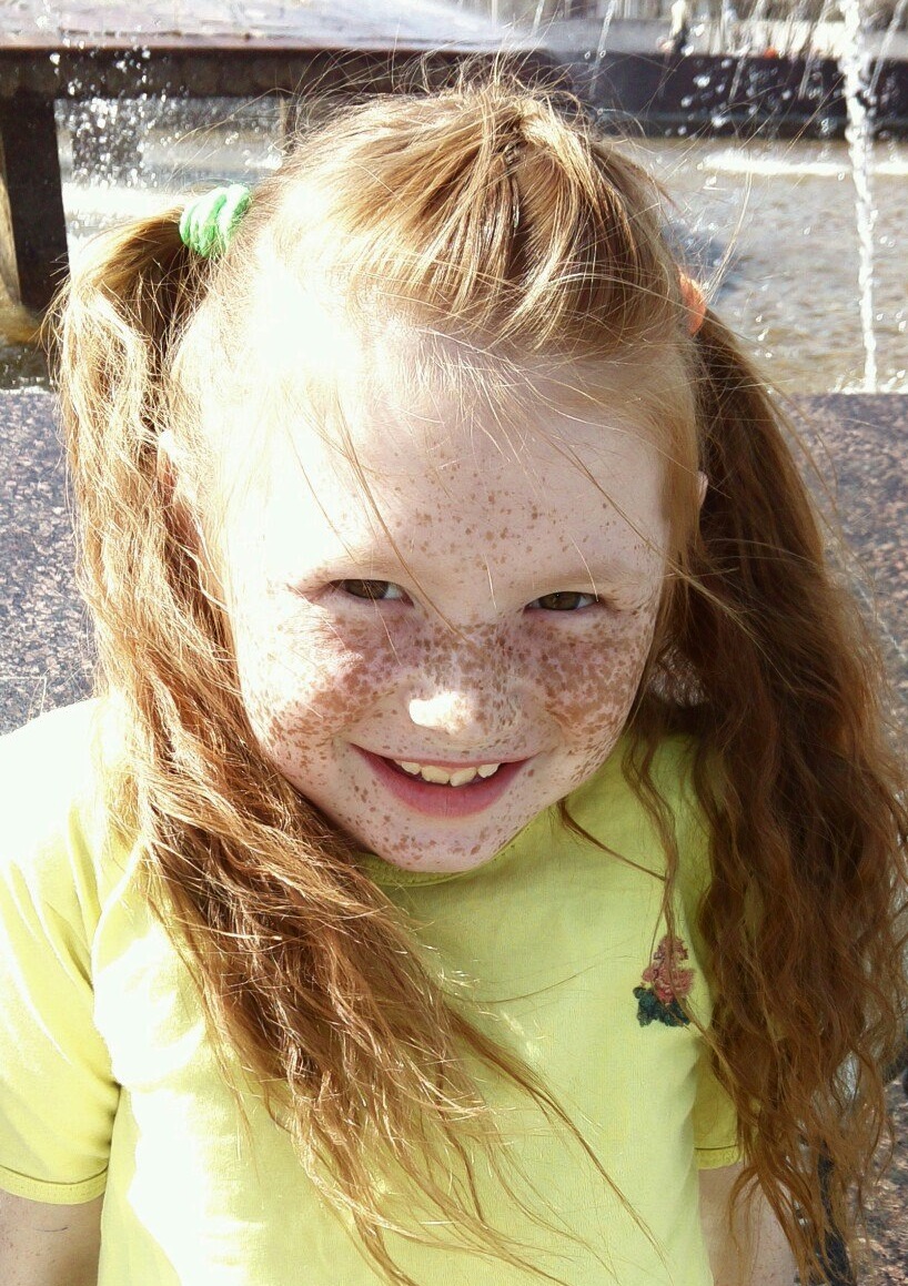 freckles-girls (10).jpg
