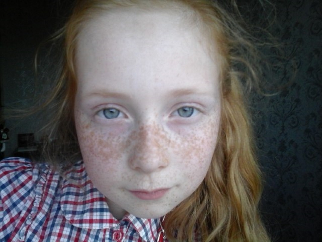 freckles-girls (12).jpg
